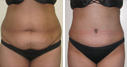 Before & After Photos
